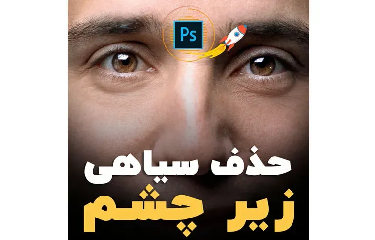 حذف سیاهی زیر چشم در فتوشاپ