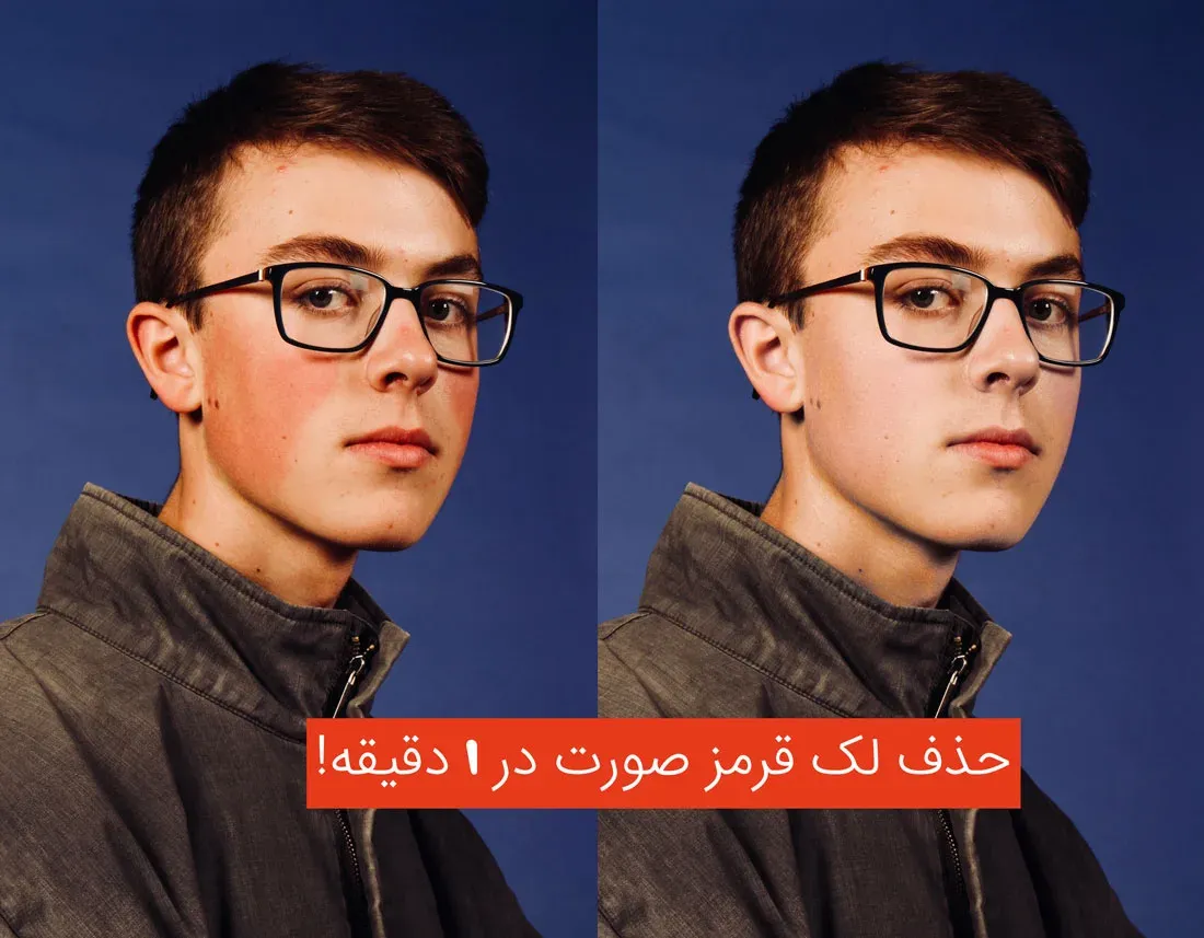 آموزش حذف لکه قرمز صورت در فتوشاپ