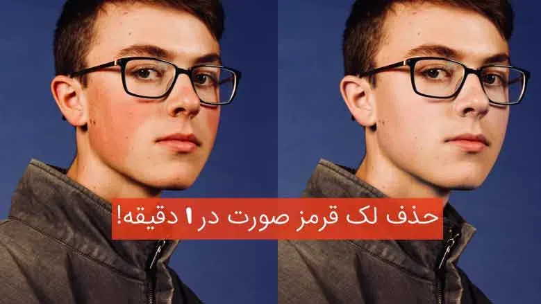 آموزش حذف لکه قرمز صورت در فتوشاپ